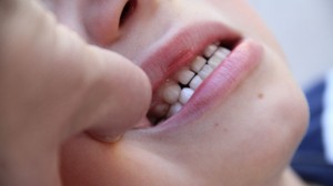 Zahnschmerzen